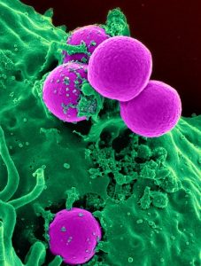 white blood cells attacking bacteria