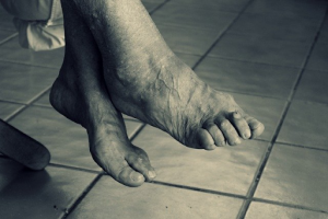 Elderly feet